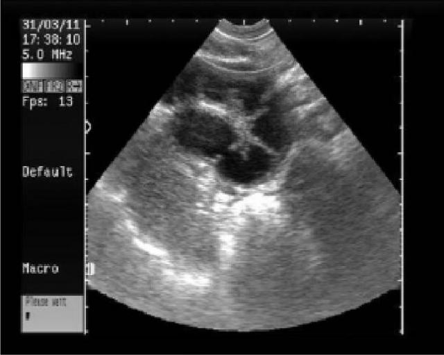 图2：黑背犬子宫蓄脓子宫囊肿声像图