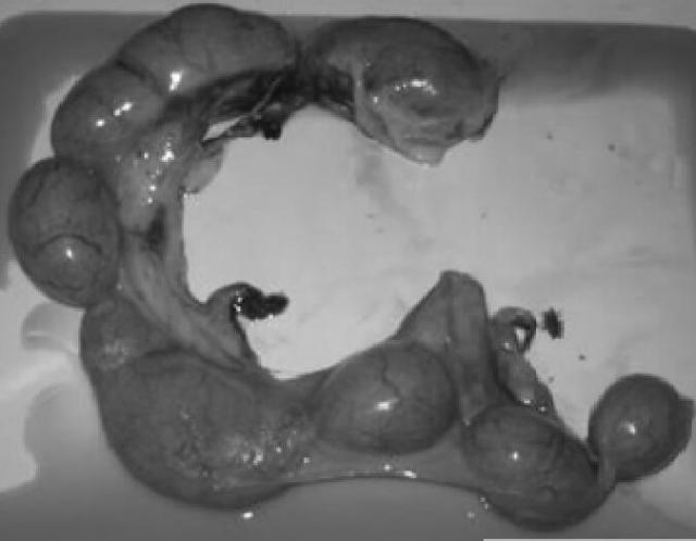 图5：腊肠犬手术切除的子宫和黄色脓性分泌物