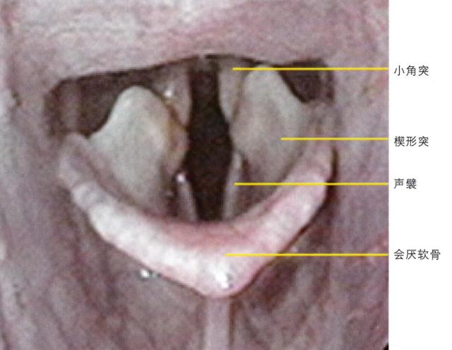 喉部解剖示意图
