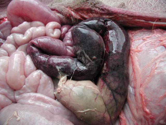 血运性肠梗阻图片