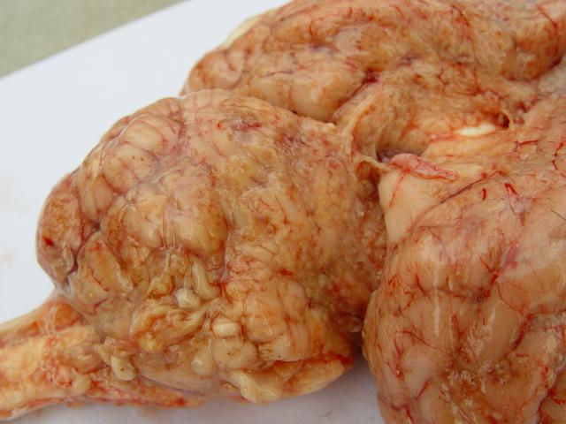 软脑膜上的粟粒状结核结节