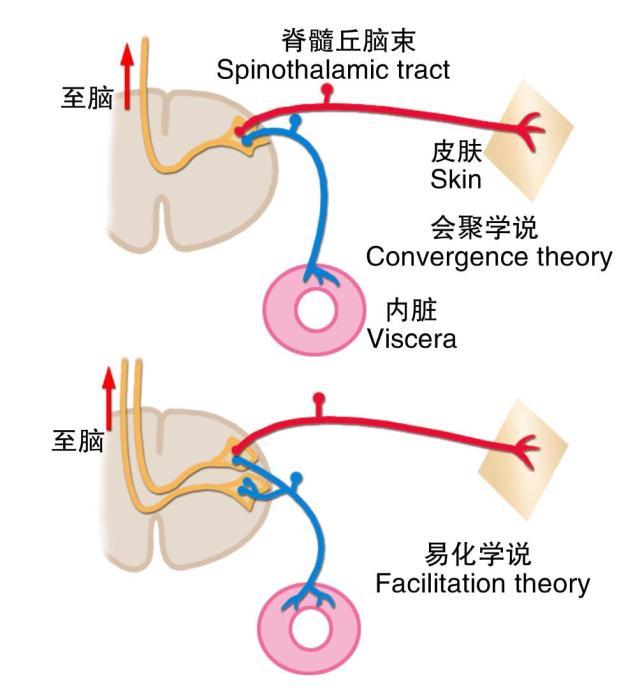 牵涉痛的会聚学说和易化学说示意图