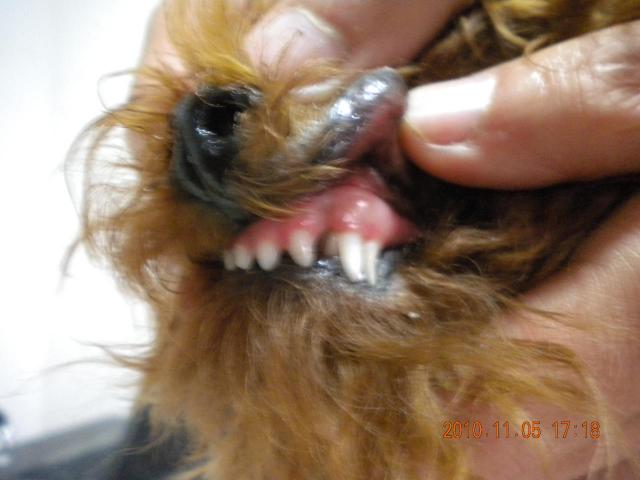 牙齿及齿龈检查