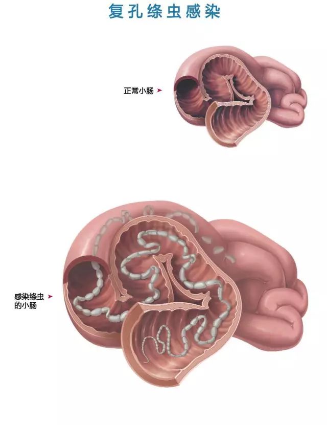 泌尿系统寄生虫图片