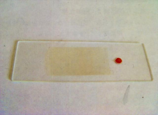 血片制作5：推制好的未染色的干燥血片