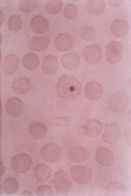 红细胞内的犬瘟热病毒包涵体