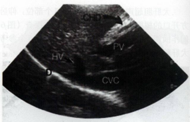 犬肝胆第3矢状面声像图