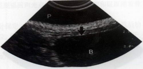犬膀胱纵切面声像图：清晰显示腹侧膀胱壁（箭头所示），对于膀胱炎诊断有重要意义