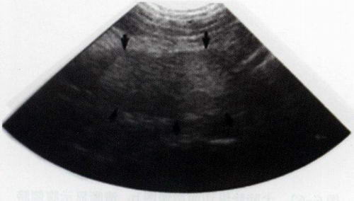 公犬前列腺横切面声像图：前列腺呈双叶状（箭头所指），其实质回声中度均质，边缘清晰光滑