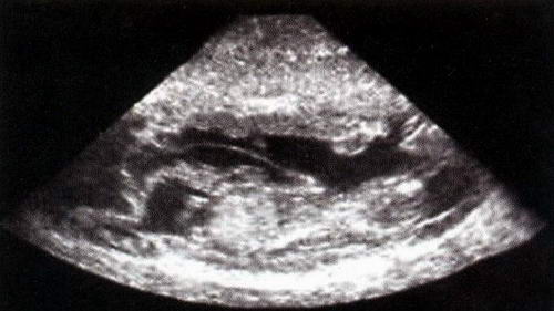 犬38日龄胚胎纵切面声像图