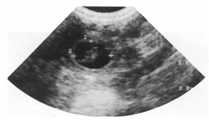 犬妊娠早期孕囊声像图