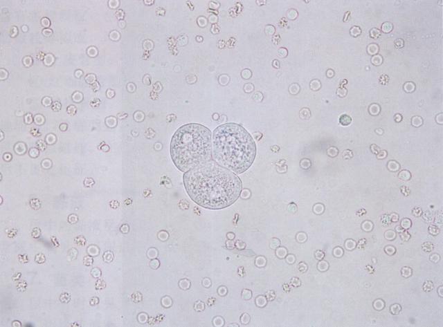 尿液小圆上皮细胞图片图片