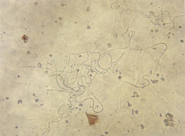 猫尿中的真菌菌丝
