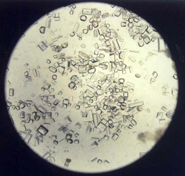 磷酸钙结晶图片图片