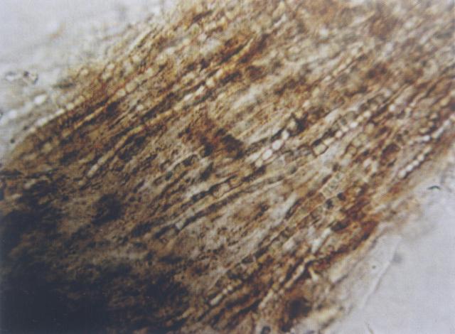 犬皮肤真菌：毛内生长的石膏样小孢子菌