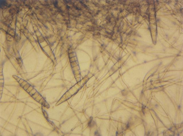 犬皮肤真菌：犬小孢子菌的菌丝和孢子